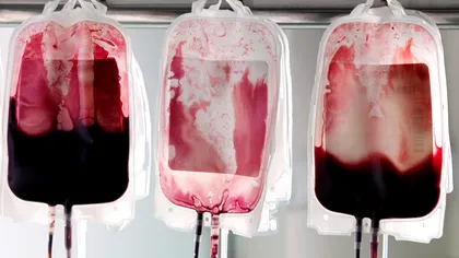 Cercetătorii reușesc să creeze celule rezistente la virusul HIV