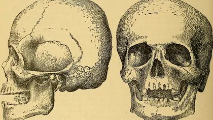 Oamenii antici aveau parte de clipe de coșmar când mergeau la dentist