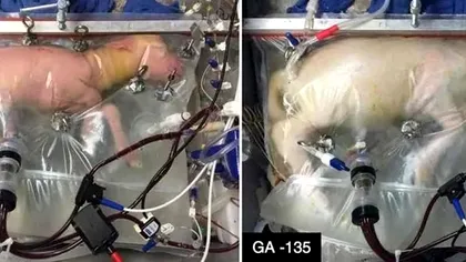 Sacii din plastic, ”pântecele” viitorului: cum i-ar putea ajuta pe copiii născuți prematur