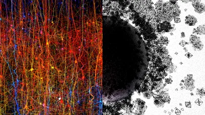 Creierul uman poate crea structuri neuronale complexe în 11 dimensiuni diferite