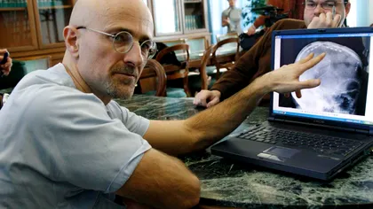 Medicul care pregătește primul transplant de cap anunță un nou progres