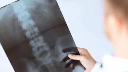 Cercetarea care s-ar putea dovedi extrem de utilă pentru cei paralizați