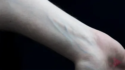 De ce îți vezi venele albastre, când sângele este roșu