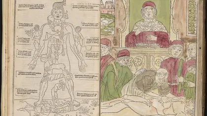 Cartea rară care îți arată schimbarea radicală din medicină în timp