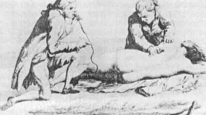 Medicina ridicolă de acum sute de ani care salva, totuși, vieți