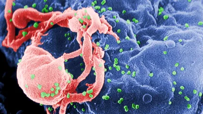 De ce apar din ce în ce mai multe epidemii virale fatale