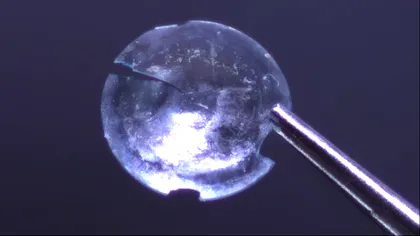 Ce se întâmplă dacă ții o lentilă de contact în ochi aproape 30 de ani