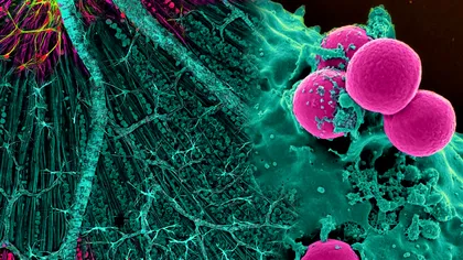 Cum poate prezice inteligența artificială evoluția cancerului