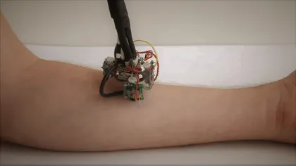 Cum arată primul robot care se poate cățăra pe pielea umană