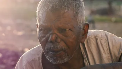 Boala care a ucis milioane de oameni încă e o problemă chiar și acum