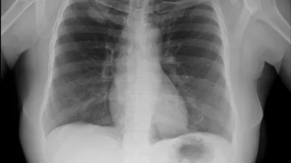 Aparatura medicală poate fi controlată de hackeri și ăsta e un coșmar