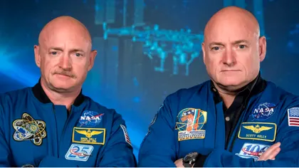 NASA iti arata ce se intampla cu corpul uman dupa un an in spatiu