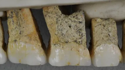 Cat de importanta e noua specie de oameni descoperita recent