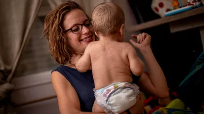 Un medicament greșit a dus la sindromul vârcolacului: cum se manifestă afecțiunea la copii