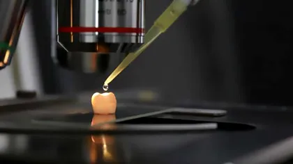 Stricarea dinților, de domeniul trecutului: un nou gel previne distrugerea smalțului