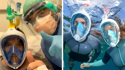 Soluția populară în Italia: au reușit să facă un aparat de ventilație din mască de scufundări
