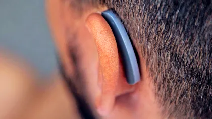 Aparatul auditiv care costă cât o cafea poate ajuta milioane de oameni