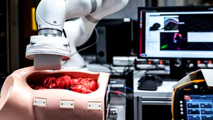 Cum te ajută roboții într-unul dintre cele mai neplăcute examene medicale