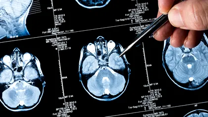 Tehnologia care poate detecta semnele afecțiunii Alzheimer doar după scrisul de mână