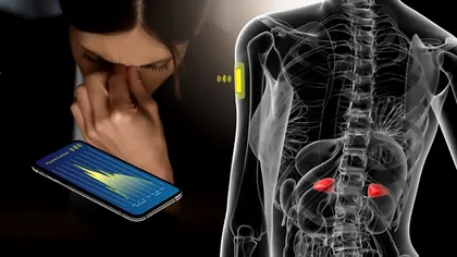 Gadgetul care îți face viața mai ușoară, la propriu: se aplică pe piele și măsoară nivelul de stres