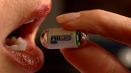 Acest experiment neobișnuit presupune să înghiți o cameră de filmat. La ce ajută acest demers