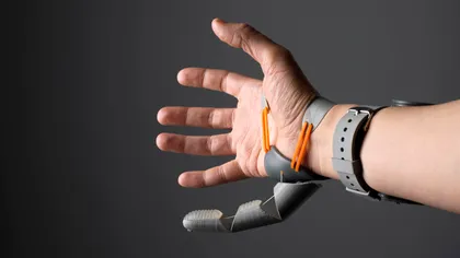 Experimentul cu al șaselea deget: răspunsul organismului uman, surprinzător