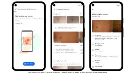 Cum te poate ajuta Google să îți diagnostichezi eventuale probleme medicale