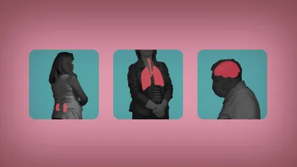 Veste bună pentru cei cu probleme după coronavirus: efectele pe termen lung ale Covid-19 se pot vindeca, în sfârșit