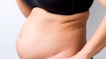 De ce ne îngrășăm: concluziile celui mai mare studiu despre metabolism realizat vreodată