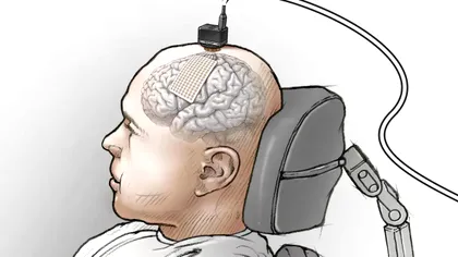 Acest nou implant cerebral transformă gândurile în text: cine e cel mai rapid dactilograf mintal