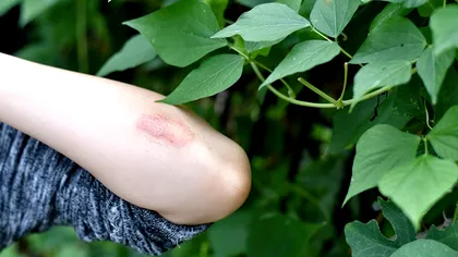 Topul celor mai otrăvitoare plante din lume