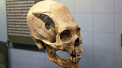 Un craniu misterios a împărțit lumea științifică în două: ce au găsit cercetătorii implantat în el