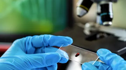 Prima femeie din lume s-a vindecat de HIV: metoda medicală care a avut succes