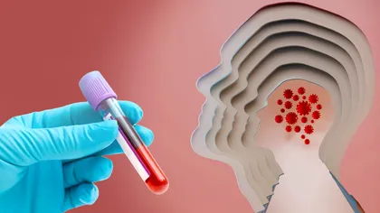 Legătura dintre sânge și bolile mintale: ce au descoperit cercetătorii