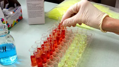 Testul de sânge care prezice exact dacă vei face infarct. Descoperirea fabuloasă în medicină