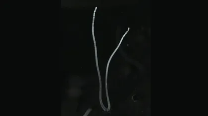 Premieră în biologie: s-a descoperit cea mai mare bacterie din lume