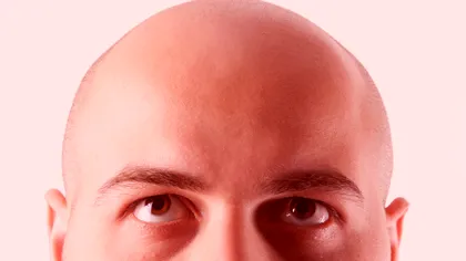 Adio, chelie! Tratamentul prin tehnici de modificare a genelor e aici și îți vei recupera părul pierdut: ce spun cercetătorii