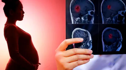 Creierul femeilor se schimbă dramatic după ce rămân însărcinate, arată un studiu