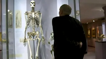 Bărbatul care a ajuns exponat de muzeu. De ce i-a fost frică, n-a scăpat: „Uriașului Irlandez” a stat expus de mai bine de 200 de ani