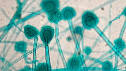 Premieră importantă în domeniul medicinei: cercetătorii, mai aproape de oprirea scenariului din The Last of Us