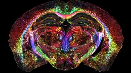 Cum arată un creier în imaginile captate de cele mai moderne aparate RMN. Detalii fără precedent. Foto