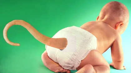 Unii copii se nasc cu cozi iar motivul nu este cel la ce te-ai putea gândi