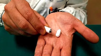 Oamenii de știință dezvoltă o cameră controlată de la distanță, în formă de pastilă, pentru a diagnostica problemele digestive