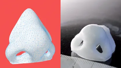 Premieră în medicină. Un nas imprimat 3D, atașat unei femei. ”Voi ieși din casă, după 10 ani”