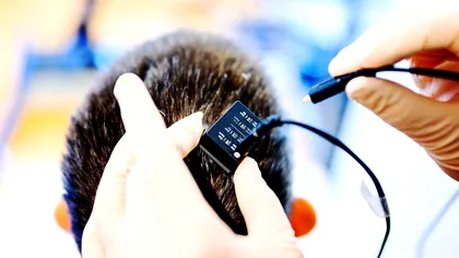 Implanturile BCI de la Synchron pot ajuta pacienții paralizați să se reconecteze cu lumea