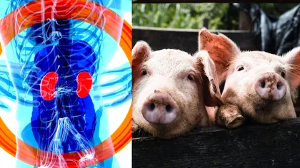 Premieră mondială: Chinezii au crescut rinichi cu celule umane în porci. „Reprezintă o nouă etapă în cercetare”