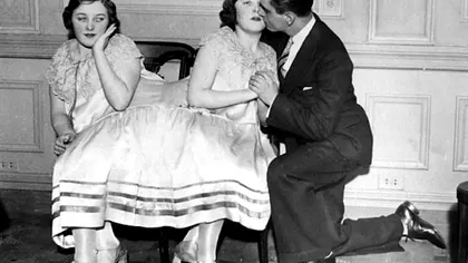 Surori până la moarte: Povestea incredibilă a siamezelor care au refuzat separarea