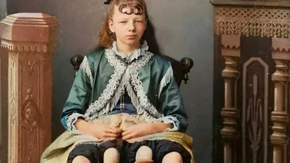Myrtle Corbin, femeia cu patru picioare: Povestea de viață fascinantă și sfârșitul său tragic