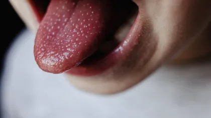 Culoarea limbii tale îți poate dezvălui starea de sănătate: Ce au descoperit oamenii de știință