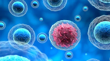 Radioterapia: Cum a fost folosită pentru a ucide cancerul și cum am putea înțelege mai bine acest proces